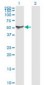 ALDH1A1 / ALDH1 Antibody (clone 1G6)